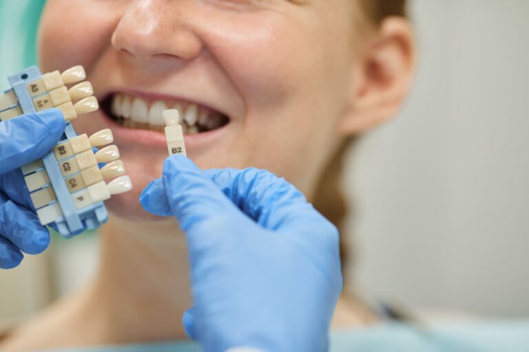 Jak długo trwa leczenie implantologiczne? Dentysta dobierający odcień korony implantologicznej pacjentowi, co jest częścią procesu leczenia.