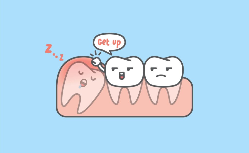 Humorystyczna ilustracja zatrzymanego zęba mądrości, symbolizująca trudności z wyrzynaniem się i wpływ na sąsiednie zęby.
