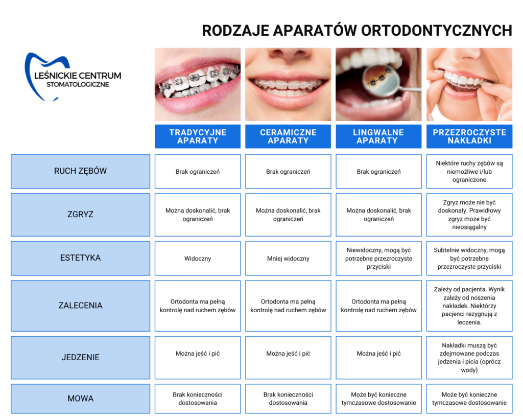 Rodzaje aparatów ortodontycznych